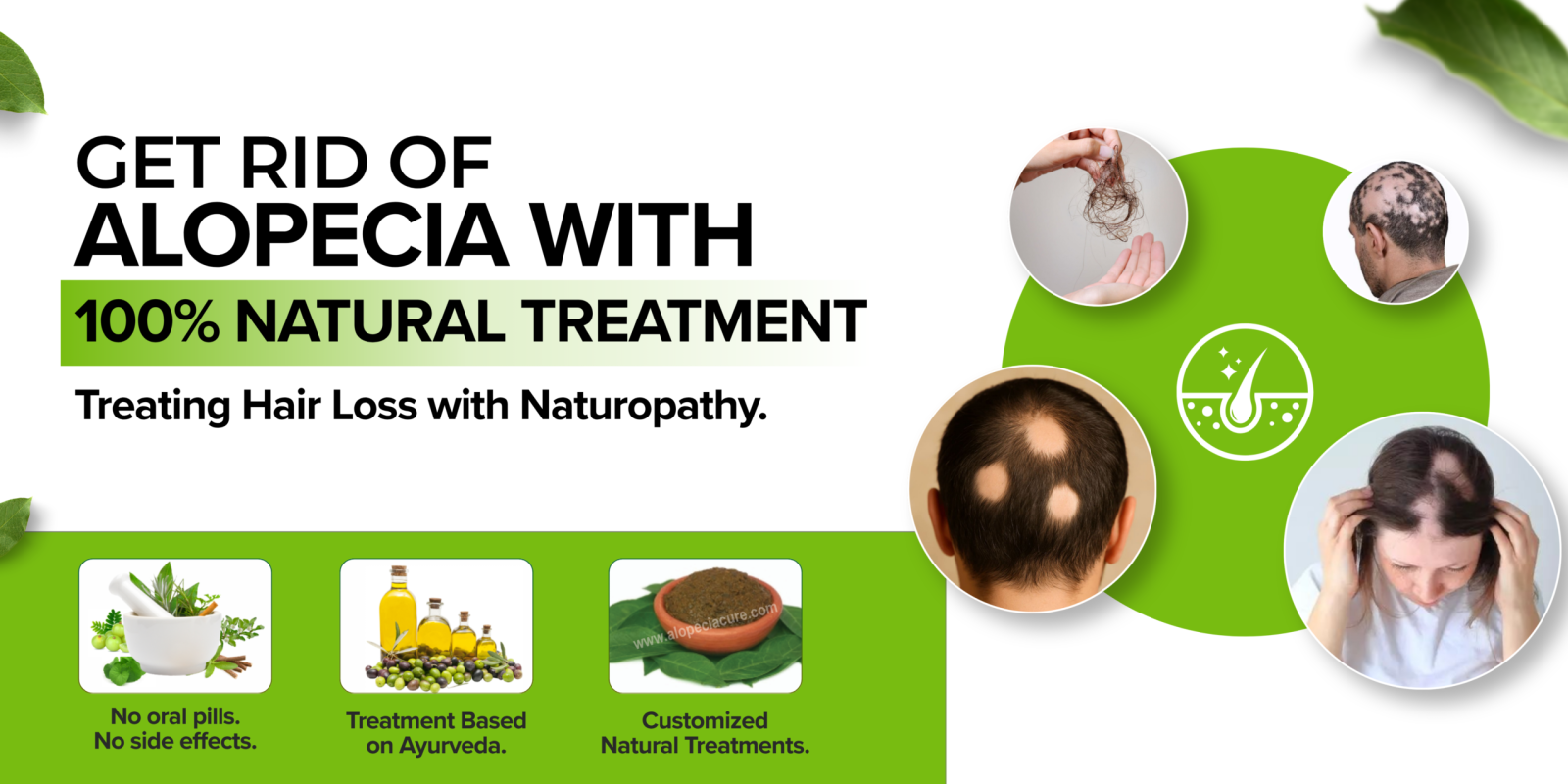ALOPECIA BANNER